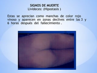 SIGNOS DE MUERTE
Livideces: (Hipostasis )
Estas se aprecian como manchas de color rojo
vinoso y aparecen en zonas declives entre las 3 y
6 horas después del fallecimiento .
 