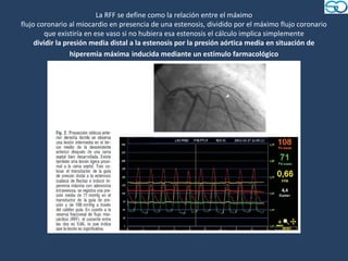 La RFF se define como la relación entre el máximo
flujo coronario al miocardio en presencia de una estenosis, dividido por el máximo flujo coronario
         que existiría en ese vaso si no hubiera esa estenosis el cálculo implica simplemente
     dividir la presión media distal a la estenosis por la presión aórtica media en situación de
                  hiperemia máxima inducida mediante un estímulo farmacológico
 