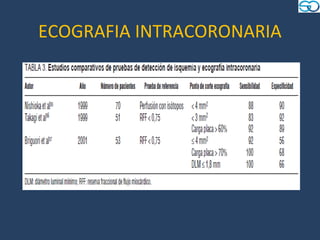 ECOGRAFIA INTRACORONARIA
 