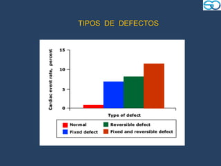 TIPOS DE DEFECTOS
 