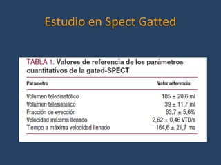 Estudio en Spect Gatted
 