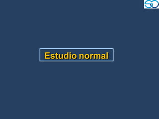 Estudio normal
 