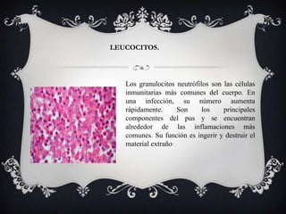 LEUCOCITOS.




   Los granulocitos neutrófilos son las células
   inmunitarias más comunes del cuerpo. En
   una infección, su número aumenta
   rápidamente.     Son      los    principales
   componentes del pus y se encuentran
   alrededor de las inflamaciones más
   comunes. Su función es ingerir y destruir el
   material extraño
 