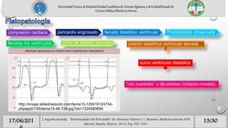 13/3017/06/201 J. Sagrista Sauleda, “Enfermedades del Pericardio”. En: Farreras-Valenti y C. Rozman. Medicina Interna XVII
Edicion. España, Elseiver, 2012. Pag. 527-535-
Universidad Técnica de Machala/Unidad Académica de Ciencias Químicas y de la Salud/Escuela de
Ciencias Médicas/Medicina Interna
compresión cardiaca pericardio engrosado llenado diastólico ventricular Protodiástole conservada
llenarse los ventrículos curva de presión auricular presión diastólica ventricular elevada
http://image.slidesharecdn.com/tema15-120416124754-
phpapp01/95/tema15-46-728.jpg?cb=1334580694
curva ventricular diastolica
“raiz cuadrada” o dip-plateau (colapso-meseta).
 