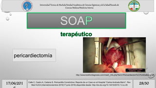 Universidad Técnica de Machala/Unidad Académica de Ciencias Químicas y de la Salud/Escuela de
Ciencias Médicas/Medicina Interna
28/3017/06/201 Calle C, Castro A, Cadena S. Pericarditis Constrictiva: Reporte de un Caso en el Hospital “Carlos Andrade Marín”. Rev
Med HJCA (internet)noviembre 2015(17 junio 2016).disponible desde: http://dx.doi.org/10.14410/2015.7.3.cc.49
SOA
pericardiectomía
http://www.lookfordiagnosis.com/mesh_info.php?term=Pericardiectom%C3%ADa&lang=2#
 