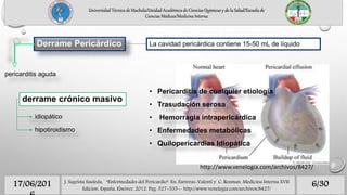Derrame Pericárdico
6/3017/06/201 J. Sagrista Sauleda, “Enfermedades del Pericardio”. En: Farreras-Valenti y C. Rozman. Medicina Interna XVII
Edicion. España, Elseiver, 2012. Pag. 527-535 - http://www.venelogia.com/archivos/8427/
La cavidad pericárdica contiene 15-50 mL de líquido
pericarditis aguda
derrame crónico masivo
idiopático
hipotiroidismo
Universidad Técnica de Machala/Unidad Académica de Ciencias Químicas y de la Salud/Escuela de
Ciencias Médicas/Medicina Interna
• Pericarditis de cualquier etiología
• Trasudación serosa
• Hemorragia intrapericárdica
• Enfermedades metabólicas
• Quilopericardias Idiopática
http://www.venelogia.com/archivos/8427/
 