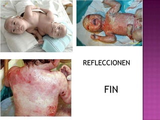 REFLECCIONEN FIN