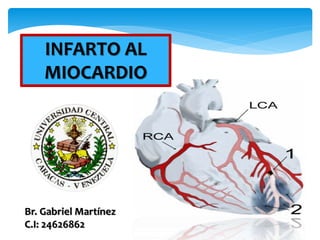 INFARTO AL 
MIOCARDIO 
Br. Gabriel Martínez 
C.I: 24626862 
 