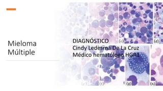 Mieloma
Múltiple
DIAGNÓSTICO
Cindy Ledesma De La Cruz
Médico hematólogo HGR1
 