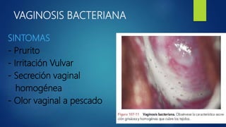 VAGINOSIS BACTERIANA
SINTOMAS
- Prurito
- Irritación Vulvar
- Secreción vaginal
homogénea
- Olor vaginal a pescado
 