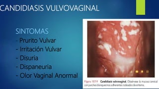 CANDIDIASIS VULVOVAGINAL
SINTOMAS
- Prurito Vulvar
- Irritación Vulvar
- Disuria
- Dispaneuria
- Olor Vaginal Anormal
 