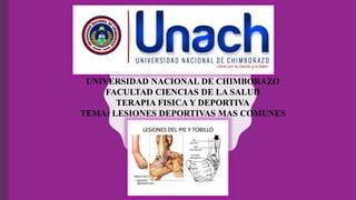 UNIVERSIDAD NACIONAL DE CHIMBORAZO
FACULTAD CIENCIAS DE LA SALUD
TERAPIA FISICA Y DEPORTIVA
TEMA: LESIONES DEPORTIVAS MAS COMUNES
 