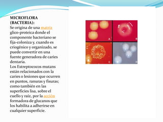 MICROFLORA
(BACTERIA):
Se origina de una matriz
glico-proteica donde el
componente bacteriano se
fija-coloniza y, cuando es
criogénico y organizado, se
puede convertir en una
fuente generadora de caries
dentaria.
Los Estreptococos mutans
están relacionados con la
caries o lesiones que ocurren
en puntos, ranuras y fisuras;
como también en las
superficies lisa, sobre el
cuello y raíz, por la acción
formadora de glucanos que
los habilita a adherirse en
cualquier superficie.
 
