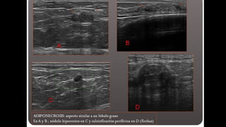 Comprehensive Ultrasound Diagnosis of Dermatological and Subcutaneous ...