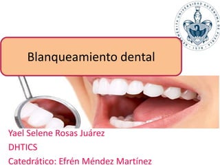 Yael Selene Rosas Juárez
DHTICS
Catedrático: Efrén Méndez Martínez
Blanqueamiento dental
 
