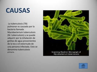 CAUSAS
 La tuberculosis (TB)
pulmonar es causada por la
bacteria llamada
Mycobacterium tuberculosis
(M. tuberculosis) y se puede
adquirir por la inhalación de
gotitas de agua provenientes
de la tos o el estornudo de
una persona infectada. Esto se
denomina tuberculosis
primaria.
 