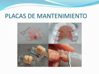 PLACAS DE MANTENIMIENTO
 