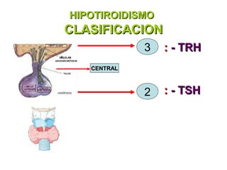 HIPOTIROIDISMO
CLASIFICACION
             3   : - TRH
   CENTRAL



             2   : - TSH
 