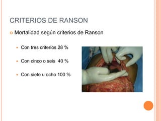 CRITERIOS DE RANSON
 Mortalidad según criterios de Ranson
 Con tres criterios 28 %
 Con cinco o seis 40 %
 Con siete u ocho 100 %
 