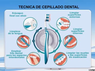 TECNICA DE CEPILLADO DENTAL
 