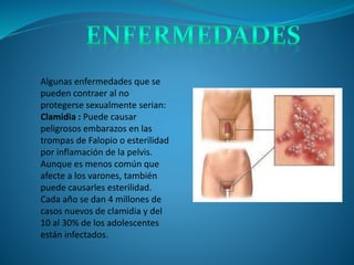 Algunas enfermedades que se
pueden contraer al no
protegerse sexualmente serian:
Clamidia : Puede causar
peligrosos embarazos en las
trompas de Falopio o esterilidad
por inflamación de la pelvis.
Aunque es menos común que
afecte a los varones, también
puede causarles esterilidad.
Cada año se dan 4 millones de
casos nuevos de clamidia y del
10 al 30% de los adolescentes
están infectados.
 