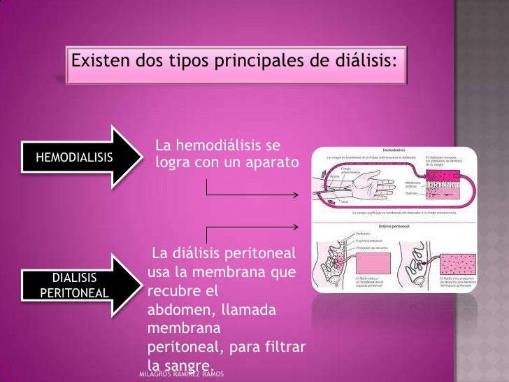 Presentación1riñon