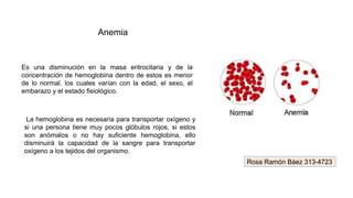 Anemia
Es una disminución en la masa eritrocitaria y de la
concentración de hemoglobina dentro de estos es menor
de lo normal. los cuales varían con la edad, el sexo, el
embarazo y el estado fisiológico.
La hemoglobina es necesaria para transportar oxígeno y
si una persona tiene muy pocos glóbulos rojos, si estos
son anómalos o no hay suficiente hemoglobina, ello
disminuirá la capacidad de la sangre para transportar
oxígeno a los tejidos del organismo.
Rosa Ramón Báez 313-4723
 