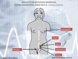 Mastografía



                             Ovario


                                  Útero

                  Próstata        Endometrio

                                  Cérvix
H. Caborca, Sonora México    Autor: Arenas Gámez José A. Dr.
 