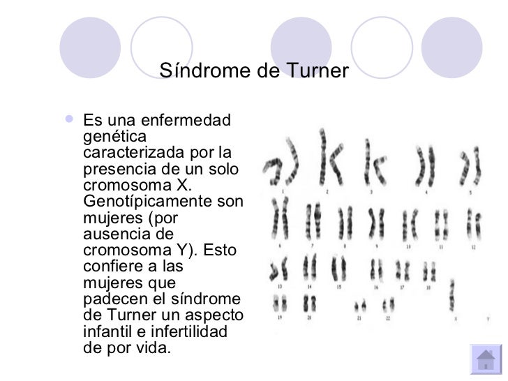 El Sindrome De Down Es Una Monosomia Y