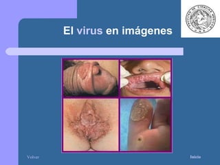 El  virus  en imágenes Inicio Volver 
