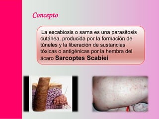 Concepto
La escabiosis o sarna es una parasitosis
cutánea, producida por la formación de
túneles y la liberación de sustancias
tóxicas o antigénicas por la hembra del
ácaro Sarcoptes Scabiei

 