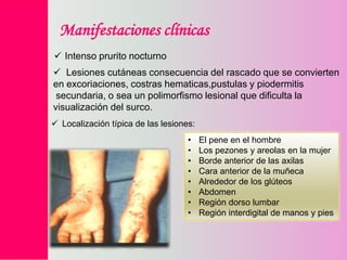 Manifestaciones clínicas
 Intenso prurito nocturno
 Lesiones cutáneas consecuencia del rascado que se convierten
en excoriaciones, costras hematicas,pustulas y piodermitis
secundaria, o sea un polimorfismo lesional que dificulta la
visualización del surco.
 Localización típica de las lesiones:
•
•
•
•
•
•
•
•

El pene en el hombre
Los pezones y areolas en la mujer
Borde anterior de las axilas
Cara anterior de la muñeca
Alrededor de los glúteos
Abdomen
Región dorso lumbar
Región interdigital de manos y pies

 