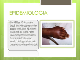 EPIDEMIOLOGIA

 
