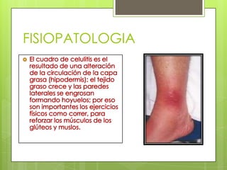 FISIOPATOLOGIA

 