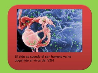 El sida es cuando el ser humano ya ha
adquirido el virus del VIH
 