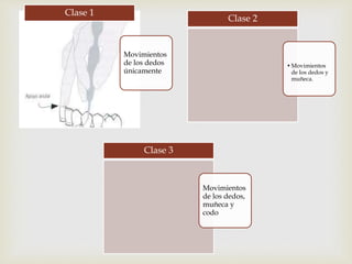 Movimientos 
de los dedos 
únicamente 
Clase 1 
•Movimientos 
de los dedos y 
muñeca. 
Clase 2 
Movimientos 
de los dedos, 
muñeca y 
codo 
Clase 3 
 