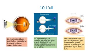 10.L'ull
La miopia es produeix
quan l'ull és massa llarg i
la imatge es forma
davant de la retina.
La hipermetropia, al
co...