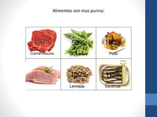Alimentos con mas purina:
cerdo
 