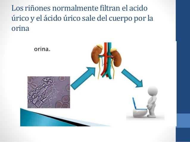 Acido úrico