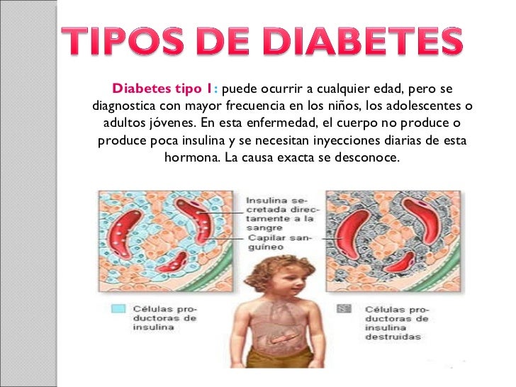 INFORMACION DE DIABETES INFORMACION DE DIABETES
