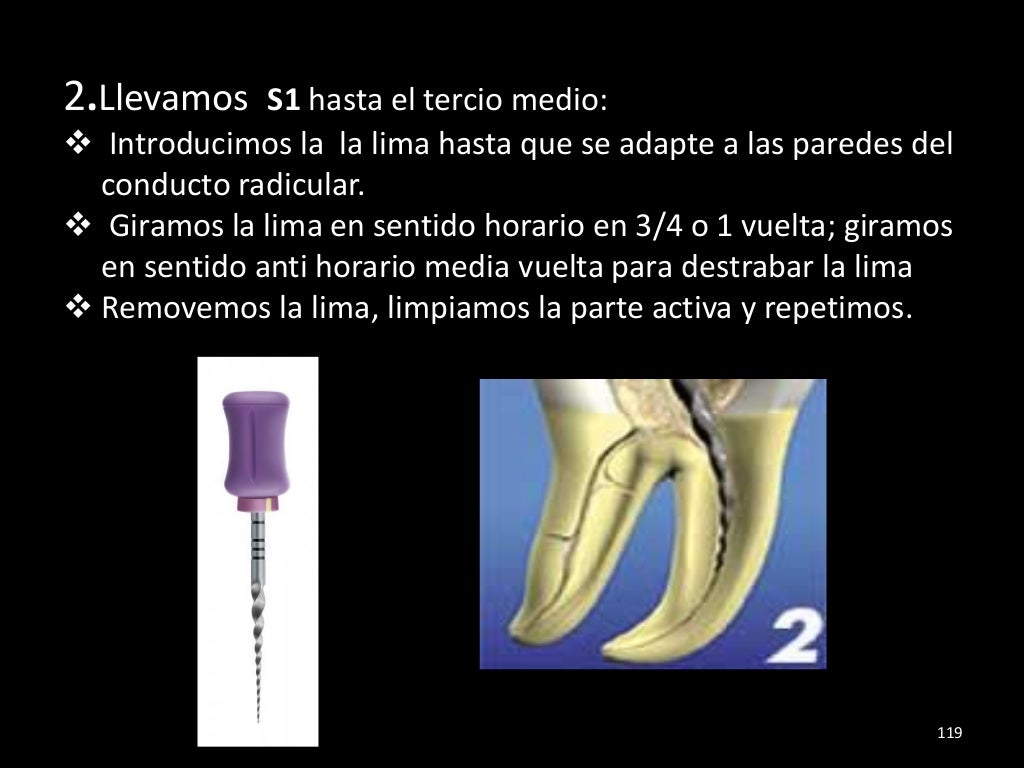 Historia de la endodoncia,tecnicas de preparacion