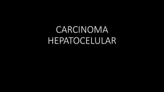 CARCINOMA
HEPATOCELULAR
 