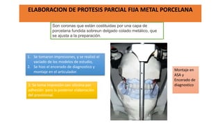 ELABORACION DE PROTESIS PARCIAL FIJA METAL PORCELANA
Montaje en
ASA y
Encerado de
diagnostico
1. Se tomaron impresiones, y se realizó el
vaciado de los modelos de estudio,
2. Se hizo el encerado de diagnostico y
montaje en el articulador.
3. Se toma impresión con silicóna por
adhesión para la posterior elaboración
del provisional.
Son coronas que están costituidas por una capa de
porcelana fundida sobreun delgado colado metálico, que
se ajusta a la preparación.
 