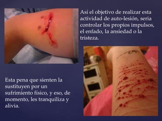 Esta pena que sienten la 
sustituyen por un 
sufrimiento físico, y eso, de 
momento, les tranquiliza y 
alivia. 
Así el objetivo de realizar esta 
actividad de auto-lesión, seria 
controlar los propios impulsos, 
el enfado, la ansiedad o la 
tristeza. 
 