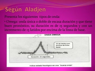  ACELERACIONES NO PERIODICAS O EPISODICASCARACTERÍSTICAS: -No tienen relación con la contracción uterina.- Son esporádicas.-Son a intervalos casi regulares.-Están relacionadas con movimientos fetales y con estímulos externos, como el estímulo de cuero cabelludo con un examen vaginal, palpación abdominal, o estímulo vibro-acústico.FISIOPATOLOGÍARespuesta positiva a la acción taquicardizante de la actividad fetal o de estímulos externos.SIGNIFICACIÓN-Buen estado del sistema nervioso autónomo.-Sistema nervioso central normal.-Sistema cardiovascular sano.