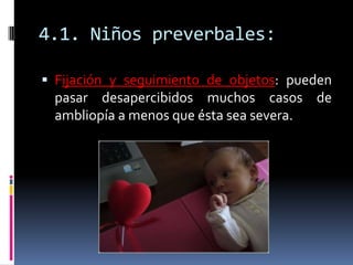 4.1. Niños preverbales:

 Fijación y seguimiento de objetos: pueden
 pasar desapercibidos muchos casos de
 ambliopía a me...