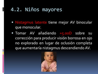 4.2. Niños mayores

 Nistagmus latente tiene mejor AV binocular
  que monocular.
 Tomar AV añadiendo +5.00D sobre su
  c...