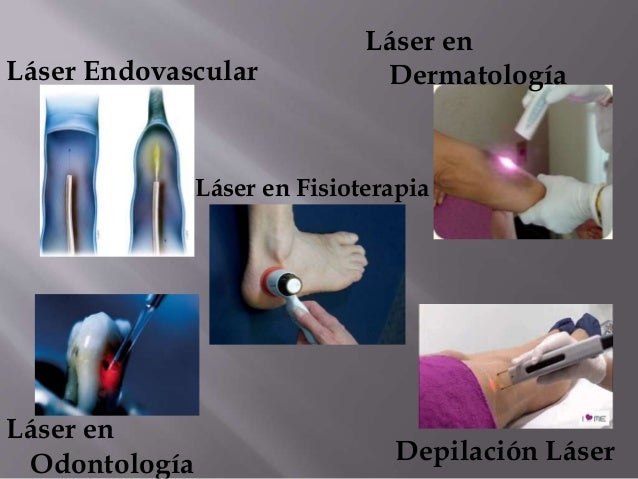 Resultado de imagen para el laser en la medicina