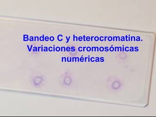 Bandeo C y heterocromatina.
Variaciones cromosómicas
numéricas
 