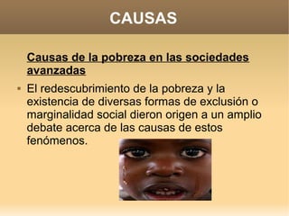 CAUSAS

    Causas de la pobreza en las sociedades
    avanzadas
   El redescubrimiento de la pobreza y la
    existencia de diversas formas de exclusión o
    marginalidad social dieron origen a un amplio
    debate acerca de las causas de estos
    fenómenos.
 